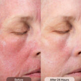 RS_cmt_post_procedure_cream_4.jpg