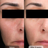 RS_dej_daily_boosting_serum_4.jpg