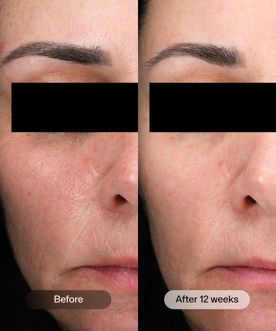 RS_dej_daily_boosting_serum_4.jpg RS_dej_daily_boosting_serum_4.jpg