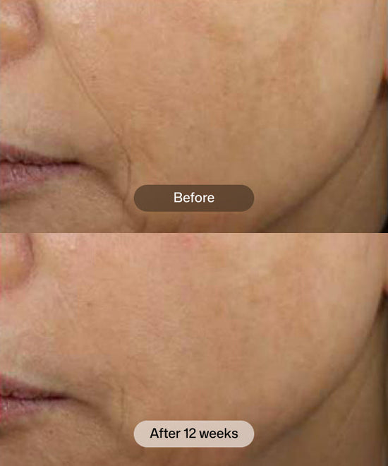 RS_dej_face_cream_4.jpg RS_dej_face_cream_4.jpg
