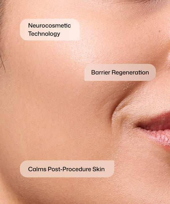 RS_cmt_post_procedure_cream_2.jpg RS_cmt_post_procedure_cream_2.jpg