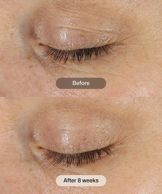 RS_dej_eye_cream_4.jpg RS_dej_eye_cream_4.jpg